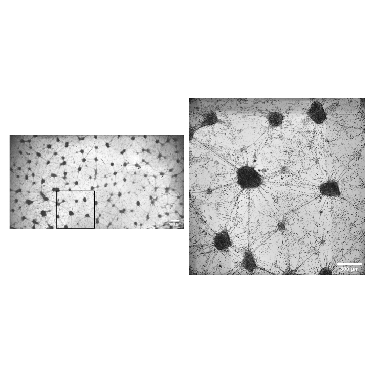 Activity dynamics in neural cultures