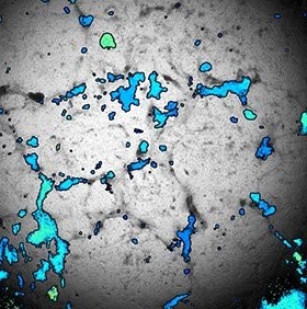 Imaging Beating Cardiomyocytes