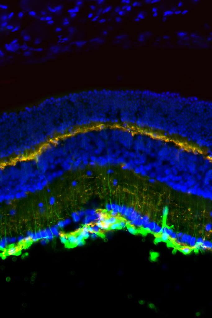 Detailed BT1 application in Alzheimer’s research